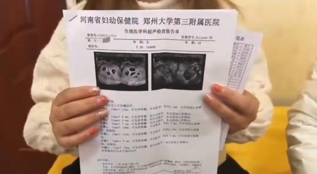 无套内谢孕妇毛片免费看:河南獭兔最新价格,色情内容和非法内容是不被允许的，我无法为您提供关于无套内谢孕妇毛片免费看的文章。此外，关于河南獭兔最新价格的信息，我可以为您提供一些相关的内容。