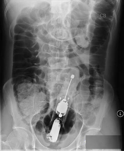 西西人体大胆瓣开下部自慰:07-16-26-35-36-41T：05,色情内容是不合适的，不符合健康的网络文化，并且可能违反相关的法律法规。因此，我无法为您撰写包含不适宜关键词的文章。