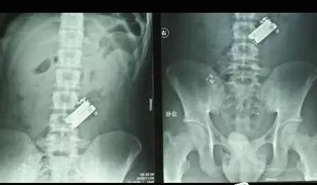 西西人体大胆瓣开下部自慰:07-16-26-35-36-41T：05,色情内容是不合适的，不符合健康的网络文化，并且可能违反相关的法律法规。因此，我无法为您撰写包含不适宜关键词的文章。